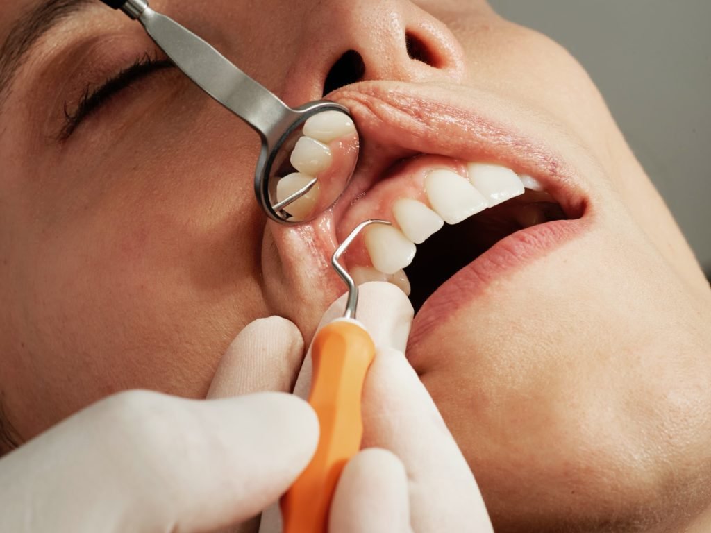 2017 World Workshop on the Classification of Periodontal and Peri-implant Diseases and Conditions