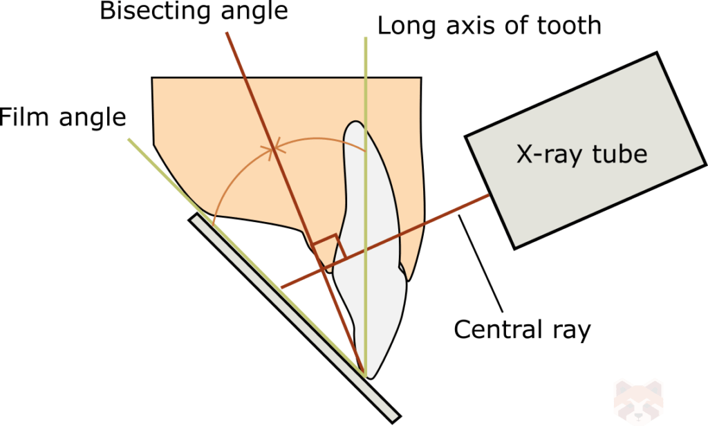 Radiography and Radiology 2 Bisecting angle 1 1024x616 1