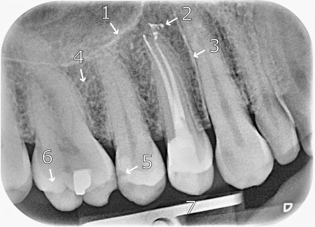 Radiography and Radiology 9 PA 1 1 1024x737 1